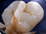 Crystal Diamond Zirconia Crystal Diamond Zirconia