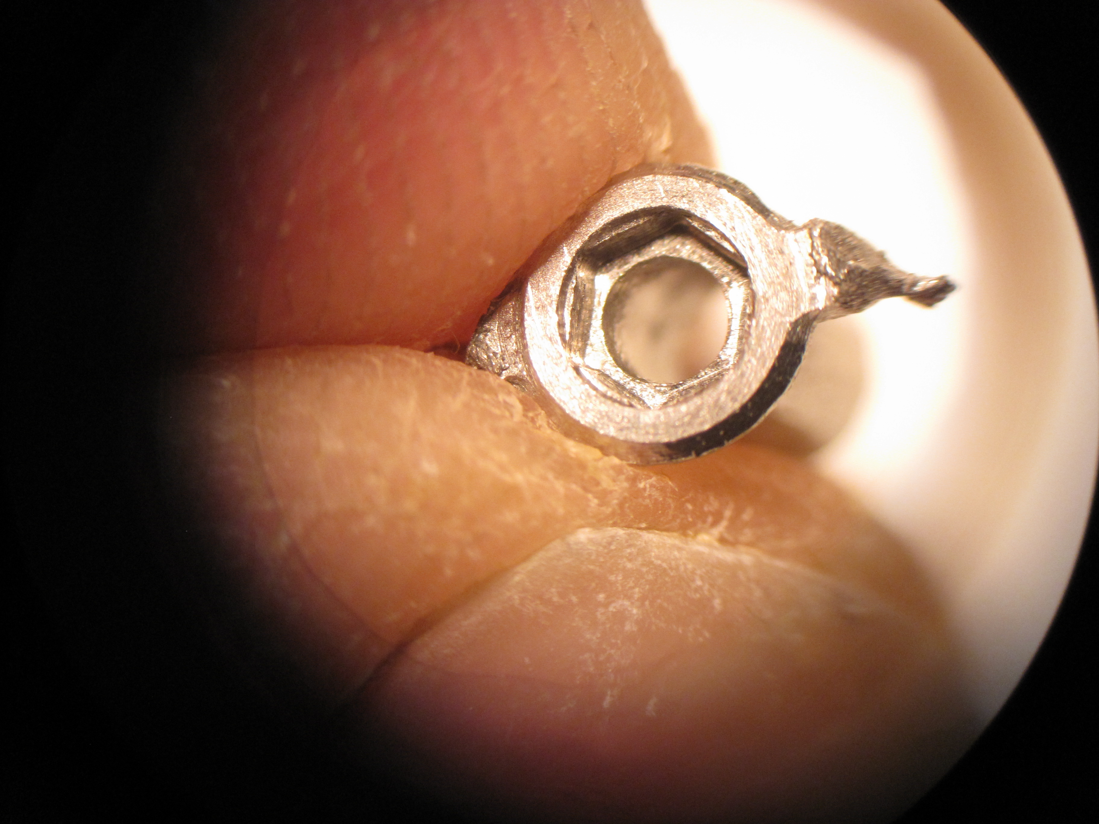 CAD-CAM Custom Abutment